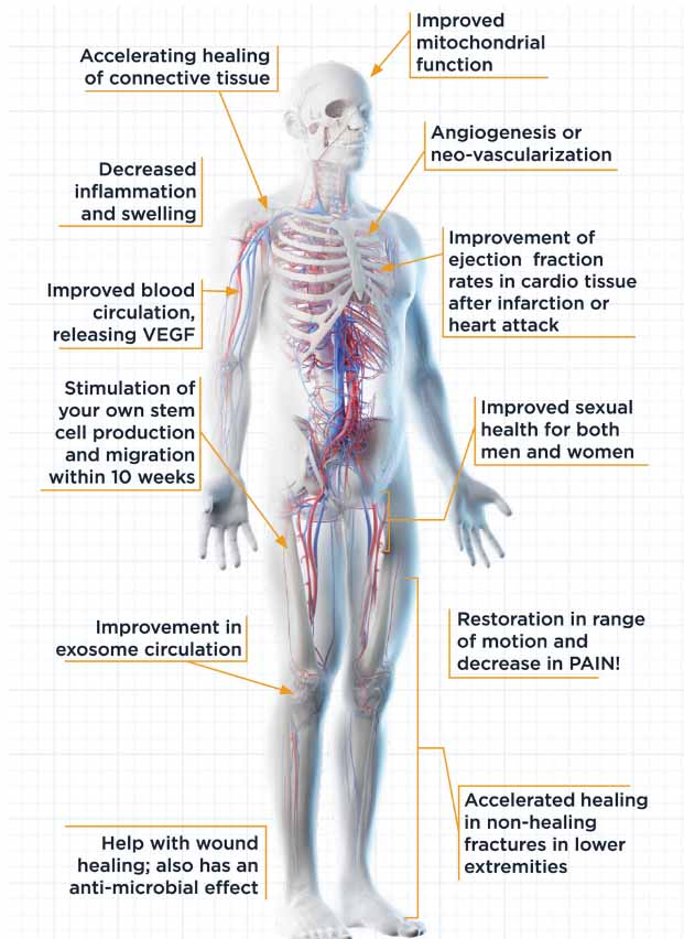 Chiropractic Cape Coral FL Softwave Therapy Benefits