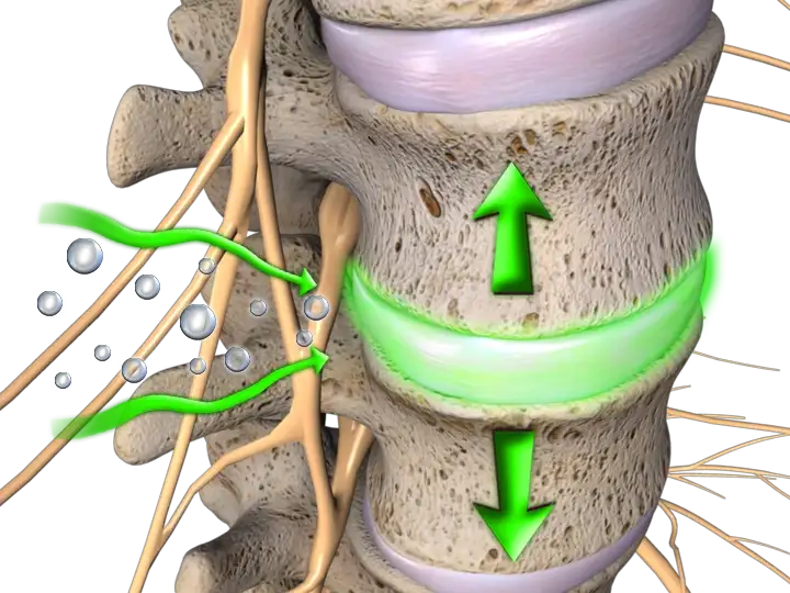 Chiropractic Cape Coral FL Spine Green 1